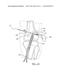 Method and Apparatus for Graft Fixation diagram and image