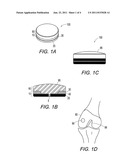 HYBRID POLYMER/METAL PLUG FOR TREATING CHONDRAL DEFECTS diagram and image