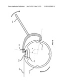 ROLLER FRAME STRETCHER diagram and image