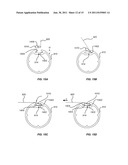 ROLLER FRAME STRETCHER diagram and image