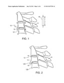 METHOD AND APPARATUS FOR MEASURING SPINAL CHARACTERISTICS OF A PATIENT diagram and image