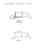 METHOD AND APPARATUS FOR MEASURING SPINAL CHARACTERISTICS OF A PATIENT diagram and image