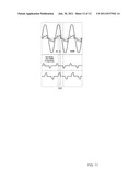 Controllable Universal Supply with Reactive Power Management diagram and image