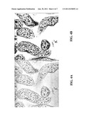 HIGH EFFICIENCY COMPUTED TOMOGRAPHY diagram and image