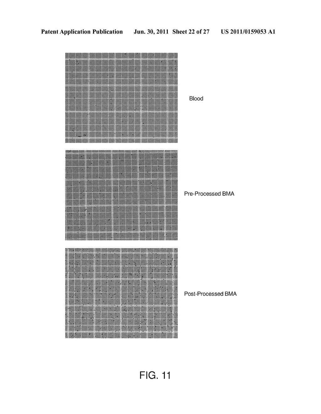 PREPARATION OF A CELL CONCENTRATE FROM A PHYSIOLOGICAL SOLUTION - diagram, schematic, and image 23