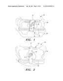 SURGICAL GUIDE AND METHOD diagram and image