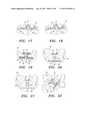 SURGICAL GUIDE AND METHOD diagram and image