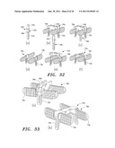 SURGICAL GUIDE AND METHOD diagram and image