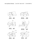 SURGICAL GUIDE AND METHOD diagram and image