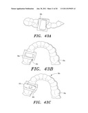 SURGICAL GUIDE AND METHOD diagram and image