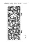 USE OF METHYLATED OR UNMETHYLATED LINE-1 DNA AS A CANCER MARKER diagram and image