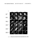 GEF-H1b: BIOMARKERS, COMPLEXES, ASSAYS AND THERAPEUTIC USES THEREOF diagram and image