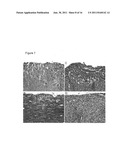 Alpha B-Crystallin as a therapy for inflammation diagram and image