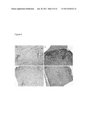 Alpha B-Crystallin as a therapy for inflammation diagram and image