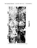 CARBOLINE DERIVATIVES USEFUL IN THE INHIBITION OF ANGIOGENESIS diagram and image