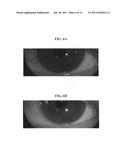 Compositions and methods for eye whitening diagram and image