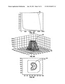 SYSTEM AND METHODS FOR USING A DYNAMIC GAMMA KNIFE FOR RADIOSURGERY diagram and image