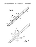 SURGICAL INSTRUMENTS FOR LAPAROSCOPIC ASPIRATION AND RETRACTION diagram and image