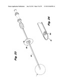 SURGICAL INSTRUMENTS FOR LAPAROSCOPIC ASPIRATION AND RETRACTION diagram and image