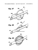 SURGICAL INSTRUMENTS FOR LAPAROSCOPIC ASPIRATION AND RETRACTION diagram and image