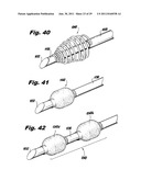 SURGICAL INSTRUMENTS FOR LAPAROSCOPIC ASPIRATION AND RETRACTION diagram and image