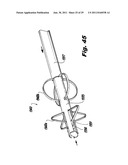 SURGICAL INSTRUMENTS FOR LAPAROSCOPIC ASPIRATION AND RETRACTION diagram and image