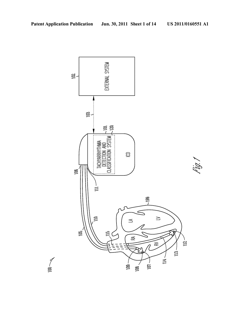 METHOD AND APPARATUS FOR MORPHOLOGY-BASED ARRHYTHMIA CLASSIFICATION USING     CARDIAC AND OTHER PHYSIOLOGICAL SIGNALS - diagram, schematic, and image 02