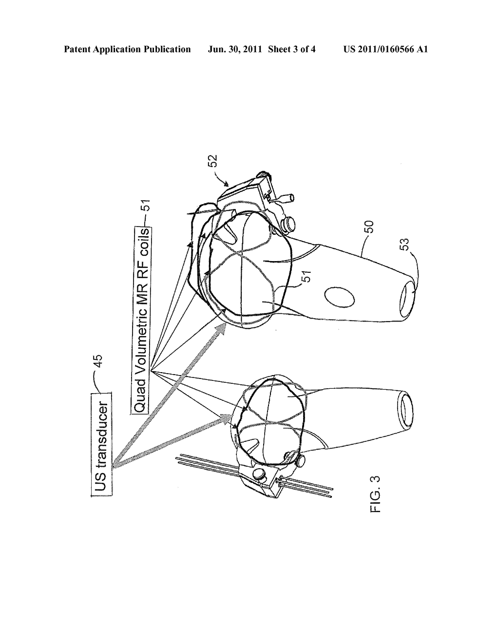 MRI AND ULTRASOUND GUIDED TREATMENT ON A PATIENT - diagram, schematic, and image 04