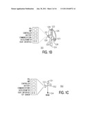 DISPOSABLE WAND AND SENSOR FOR ORTHOPEDIC ALIGNMENT diagram and image