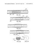 MICROPOROUS BALLOON CATHETER diagram and image