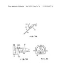 LIGHT MARKER FOR INDWELT USE IN PATIENTS BODY AND FOR IDENTIFICATION OF     LESIONS INSIDE PATIENTS TUBULAR ORGAN USING THE LIGHT MARKER diagram and image