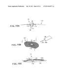 LIGHT MARKER FOR INDWELT USE IN PATIENTS BODY AND FOR IDENTIFICATION OF     LESIONS INSIDE PATIENTS TUBULAR ORGAN USING THE LIGHT MARKER diagram and image