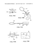 LIGHT MARKER FOR INDWELT USE IN PATIENTS BODY AND FOR IDENTIFICATION OF     LESIONS INSIDE PATIENTS TUBULAR ORGAN USING THE LIGHT MARKER diagram and image