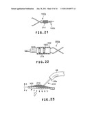 LIGHT MARKER FOR INDWELT USE IN PATIENTS BODY AND FOR IDENTIFICATION OF     LESIONS INSIDE PATIENTS TUBULAR ORGAN USING THE LIGHT MARKER diagram and image