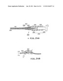 LIGHT MARKER FOR INDWELT USE IN PATIENTS BODY AND FOR IDENTIFICATION OF     LESIONS INSIDE PATIENTS TUBULAR ORGAN USING THE LIGHT MARKER diagram and image