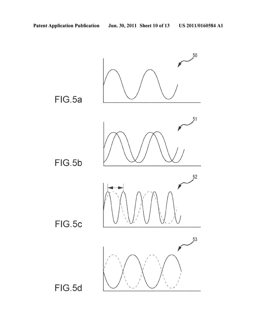 Acoustic coupling for assessment and ablation procedures - diagram, schematic, and image 11