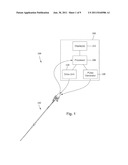 SYSTEMS AND METHODS FOR MULTI-FREQUENCY IMAGING OF PATIENT TISSUE USING     INTRAVASCULAR ULTRASOUND IMAGING SYSTEMS diagram and image