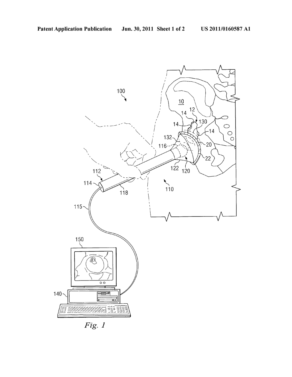 VOLUMETRIC MEASUREMENT AND VISUAL FEEDBACK OF TISSUES - diagram, schematic, and image 02