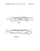 Cryo Activated Drug Delivery and Cutting Balloons diagram and image