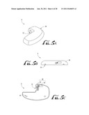 CONNECTION AND ALIGNMENT SYSTEMS AND METHODS diagram and image