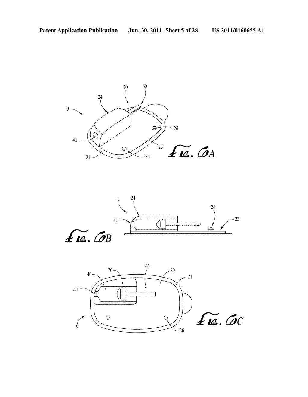 CONNECTION AND ALIGNMENT SYSTEMS AND METHODS - diagram, schematic, and image 06