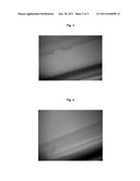 Balloon Catheter for Treating Stenosis of Body Passages and for Preventing     Threatening Restenosis diagram and image