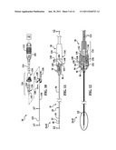 BIPOLAR CANNULA FOR USE WITH AN ELECTRODE ASSEMBLY HAVING A SEPARATE     SUPPLY ELECTRODE diagram and image