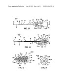 BIPOLAR CANNULA FOR USE WITH AN ELECTRODE ASSEMBLY HAVING A SEPARATE     SUPPLY ELECTRODE diagram and image