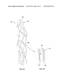 SYSTEM AND METHOD FOR DENATURING AND FIXING COLLAGENOUS TISSUE diagram and image