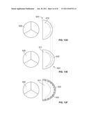 SYSTEM AND METHOD FOR DENATURING AND FIXING COLLAGENOUS TISSUE diagram and image