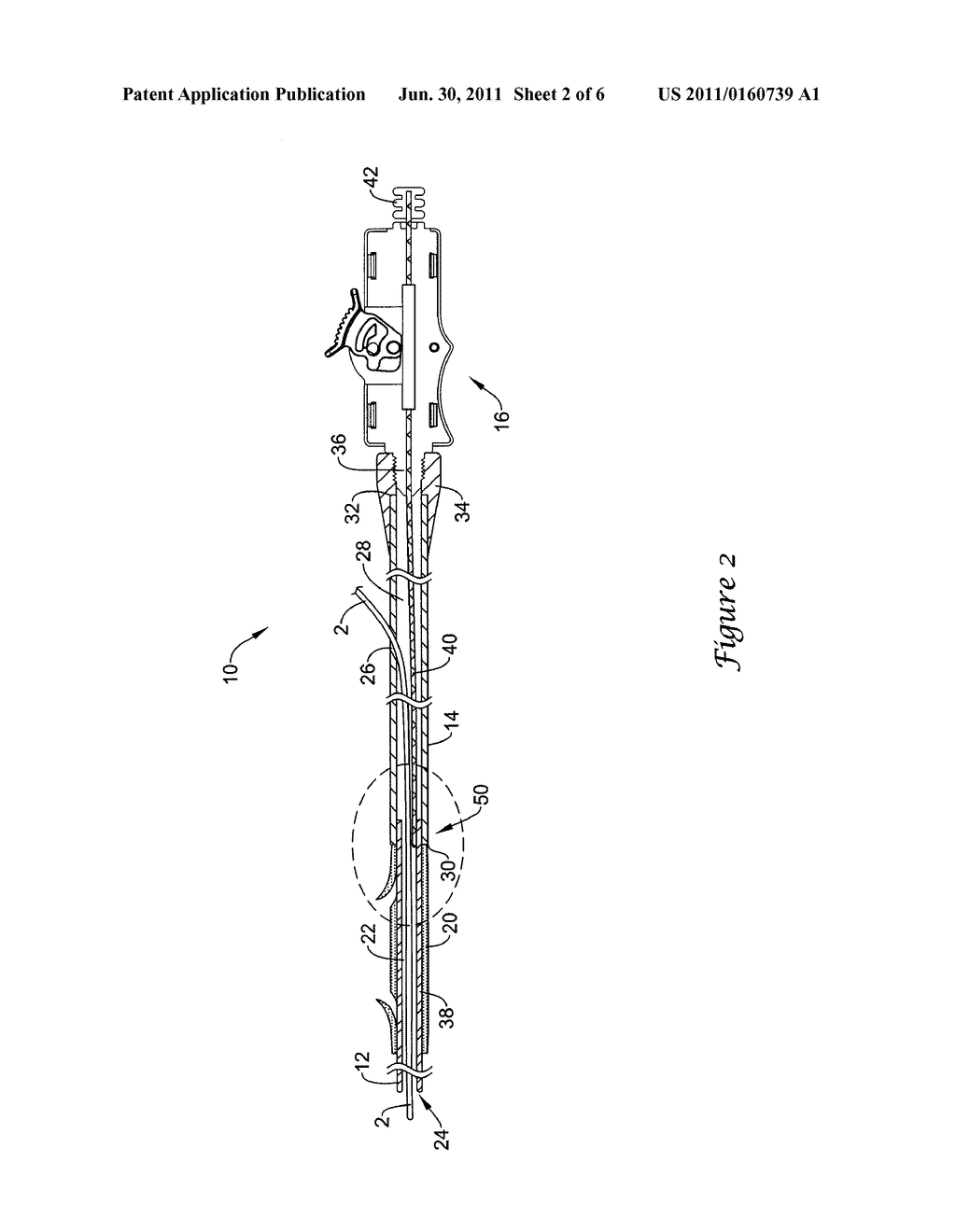 Rotatable Connection Between a Tubular Member and an Elongate Wire of a     Catheter - diagram, schematic, and image 03