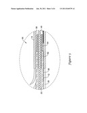 Rotatable Connection Between a Tubular Member and an Elongate Wire of a     Catheter diagram and image