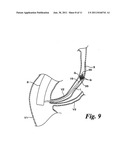 MEDICAL TREATMENT TOOL FOR TUBULAR ORGAN diagram and image