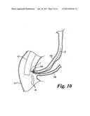 MEDICAL TREATMENT TOOL FOR TUBULAR ORGAN diagram and image